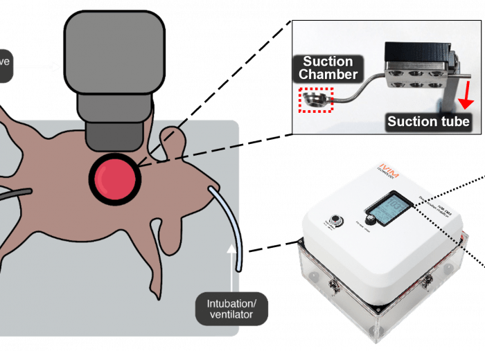 Dynamic Live Organ Imaging Using Tissue Motion Stabiliser (TMS) by IVIM Technology