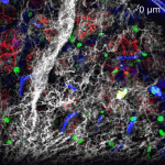 WEBINAR – Real-time IntraVital Microscopy (IVM): In Vivo Cellular-level Imaging of Internal Organs in a Live Animal