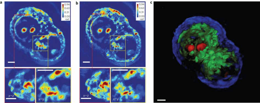 Phi Optics - Live colon carcinoma cells viewed using GLIM