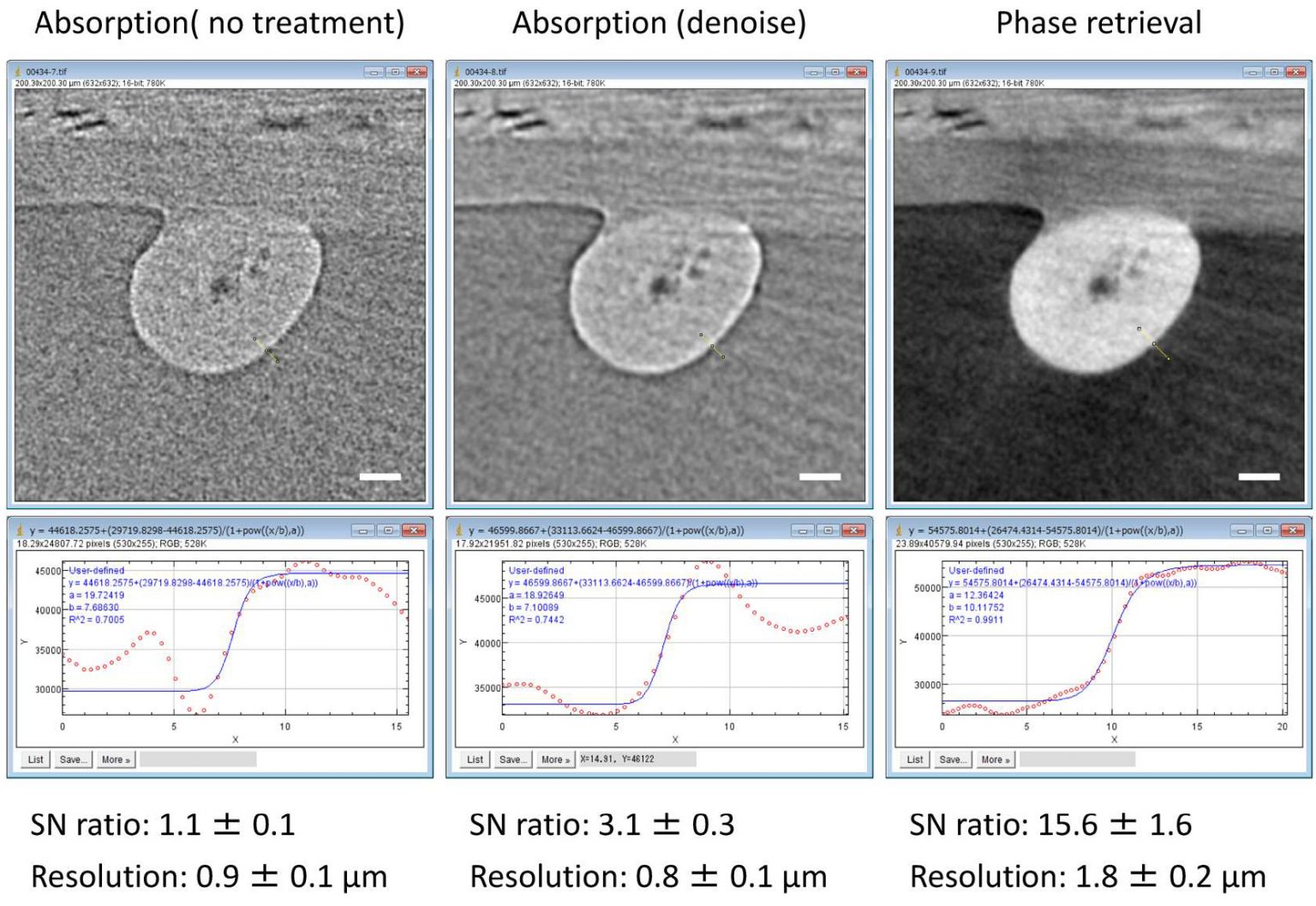 Computed Tomography Improved X Ray Imaging Using Phase Retrieval